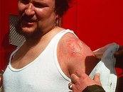 10. Leicht verletzter Feuerwehrmann image-5955